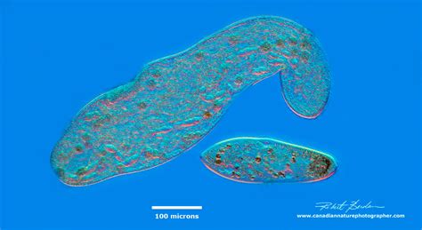  Aspidisca! Un Cilié Inattendu Qui Déjoue Nos Attentes Sur Les Microorganismes Aquatiques