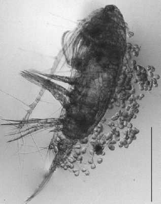  Zoothamnium: Découvre la Colonie Dansante du Monde Microscopique!