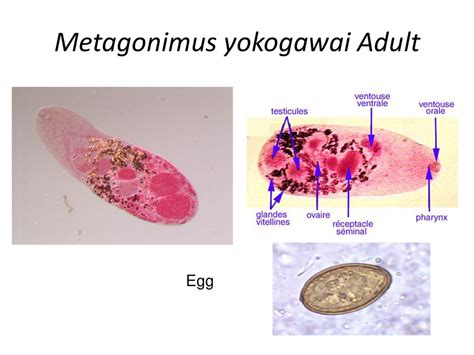  Metagonimus Yokogawai:  Un Ver Fluvial Qui Fait Danser Les Intestins!