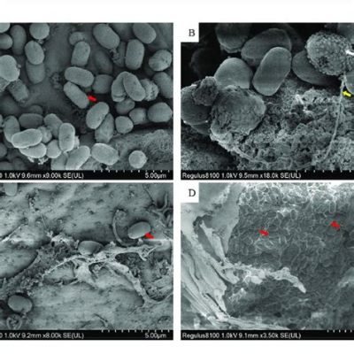  Microsporidie : Un Champion Microscopique de la Survie Parasitaire !