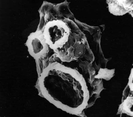  Naegleria Fowleri: Un Prédateur Microscopique Qui Se Délecte de Votre Système Nerveux!