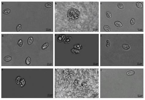  Sarcocystis ! Une histoire de parasites à multiples vies et leurs hôtes délicieusement inconscients