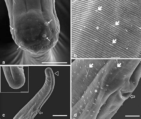  Wuchereria Bancrofti: Un ver solitaire qui aime voyager à travers le monde et s'installer confortablement dans les jambes !